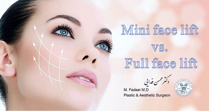 mini face lift vs. full face lift