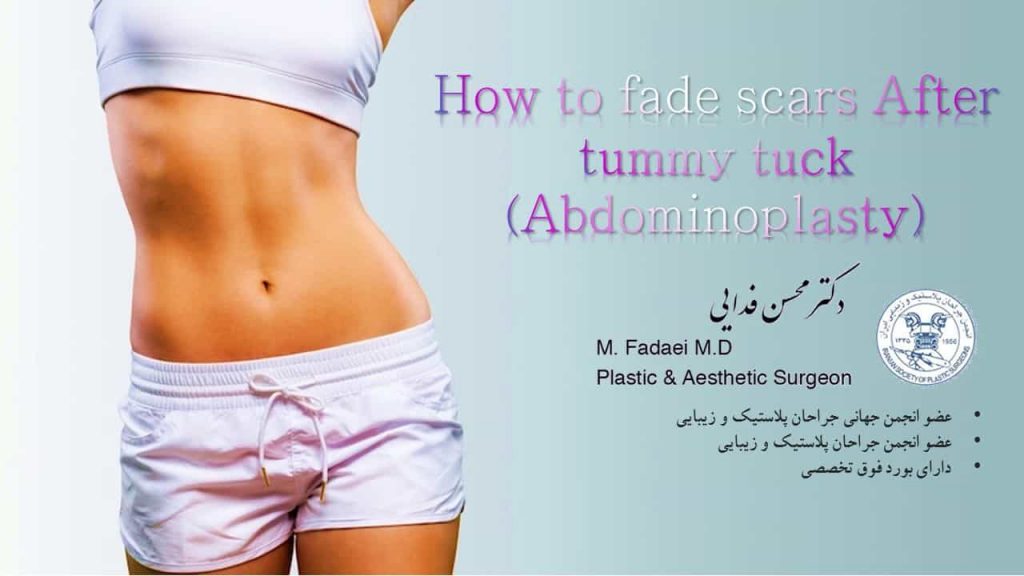 (how to fade scars After tummy tuck (Abdominoplasty
