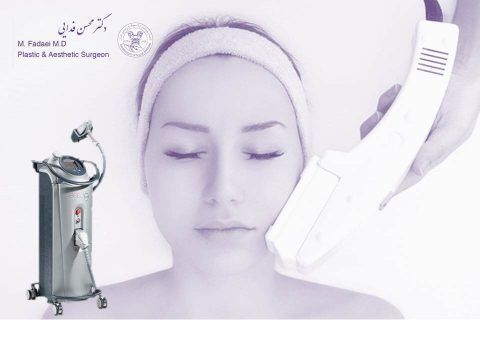 IPL laser