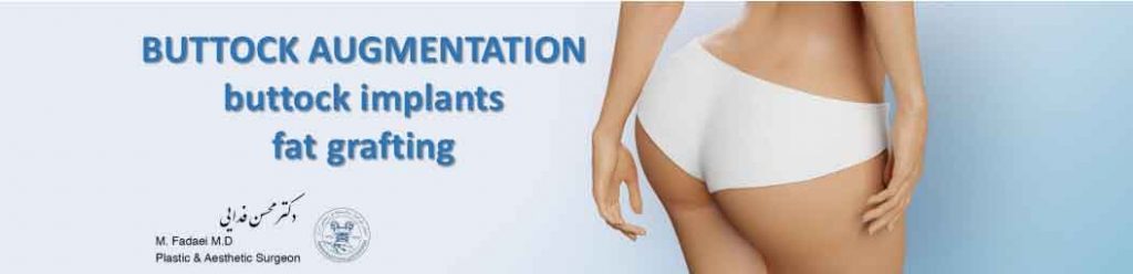 BUTTOCK AUGMENTATION : fat grafting and buttock implants
