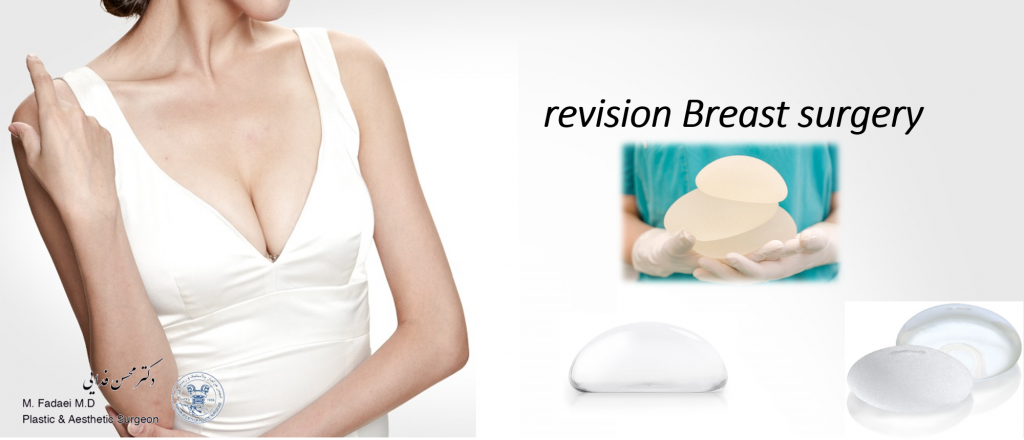 revision Breast surgery