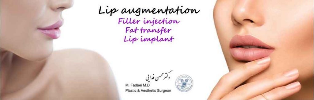 lip augmentation in Iran