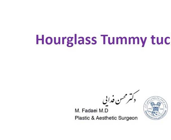 Hourglass Tummy Tuck