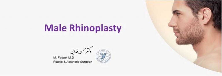 male rhinoplasty