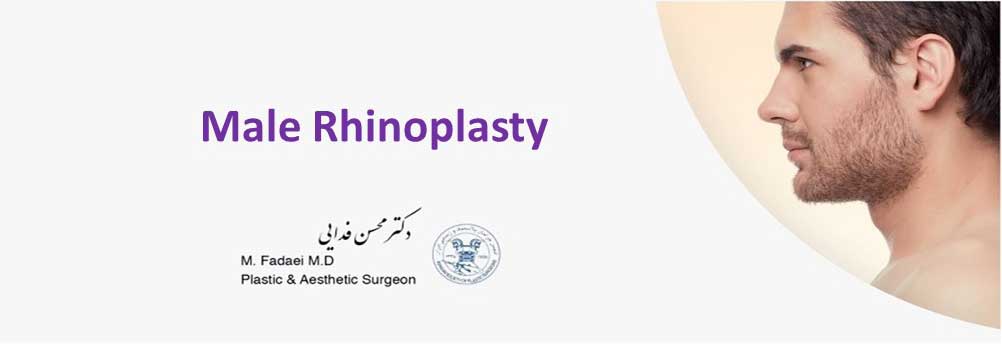male rhinoplasty