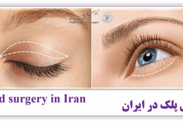 جراحی پلک در ایران - Eyelid surgery in Iran