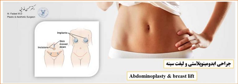 جراحی ابدومینوپلاستی و لیفت سینه - Abdominoplasty and breast lift surgery