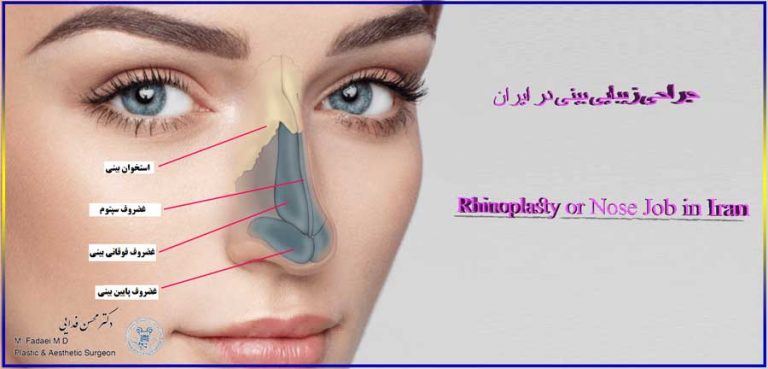 Everything about rhinoplasty in Iran