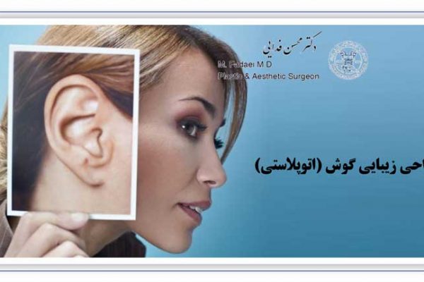 جراحی زیبایی گوش - اتوپلاستی