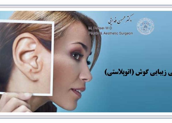 جراحی زیبایی گوش - اتوپلاستی