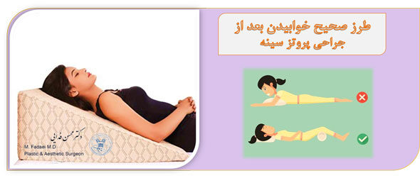 طرز صحیح خوابیدن بعد از جراحی پروتز سینه