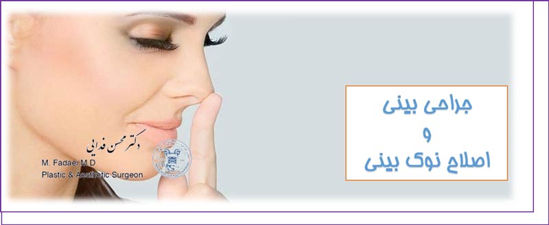اصلاح نوک بینی (tip plasty)