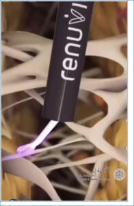 رنوویون