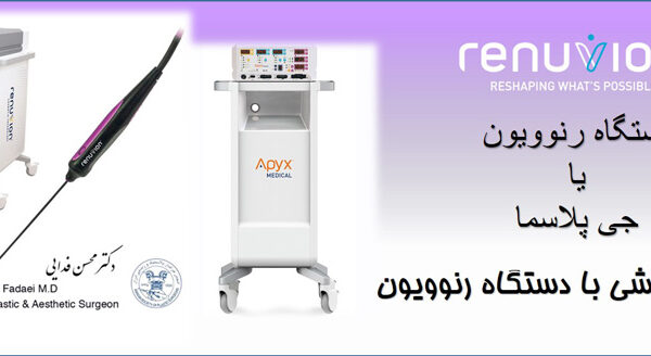 دستگاه رنوویون
