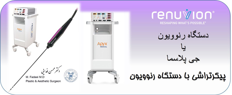 دستگاه رنوویون