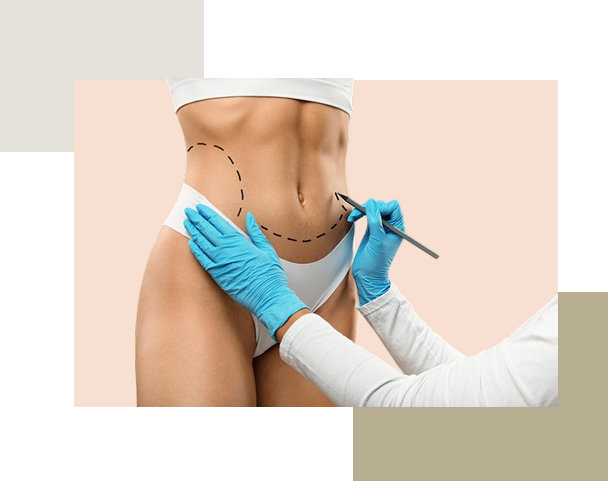 آبدومینوپلاستی