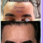 جوانسازی صورت | بهترین فوق تخصص لیفت صورت در تهران جوانسازی صورت