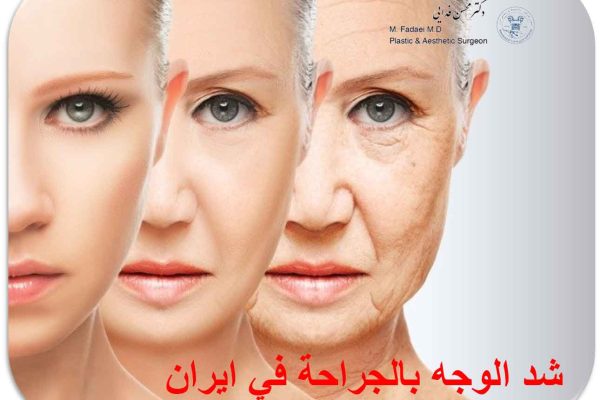 شد الوجه فی ایران