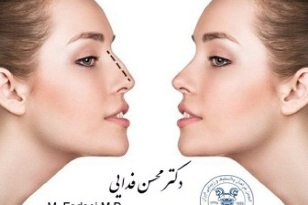 جراحی بینی و تغییر نگرش در جذابیت، موفقیت و سلامت
