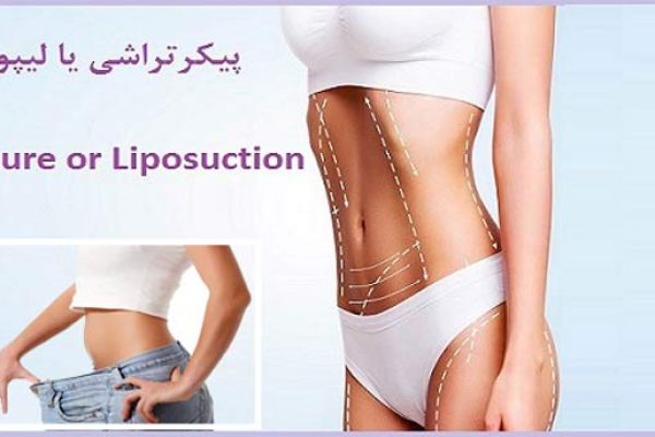 پیکرتراشی یا لیپوماتیک