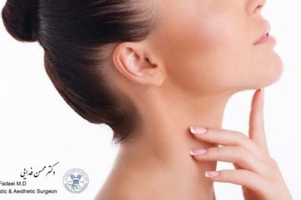 لیپوساکشن صورت