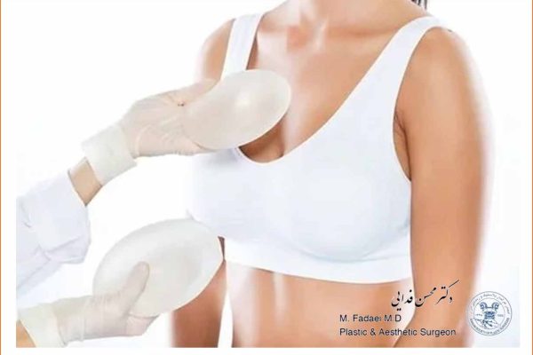 Breast Implants