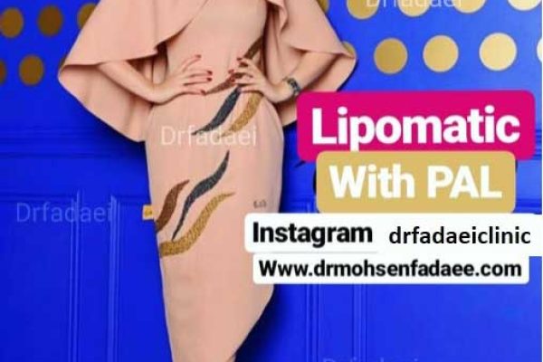 جراحی لیپوماتیک چیست ؟