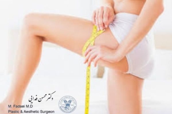 everything you should know about thigh lift