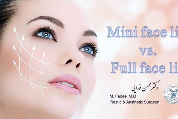 mini face lift vs. full face lift