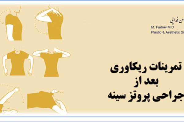 تمرینات ریکاوری بعد از جراحی پروتز سینه