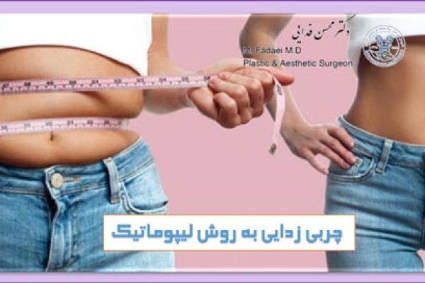 چربی زدایی به روش لیپوماتیک