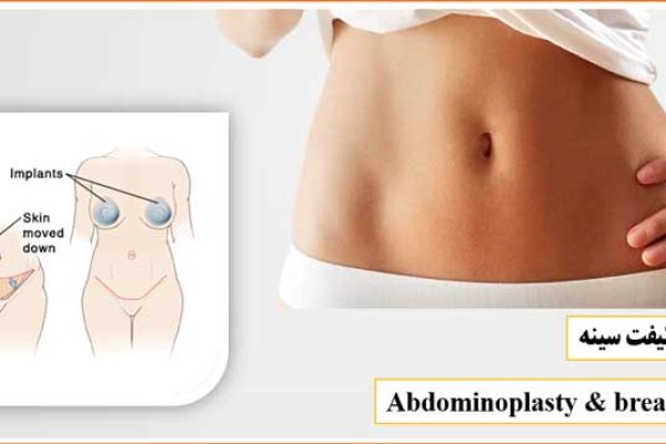 جراحی ابدومینوپلاستی و لیفت سینه - Abdominoplasty and breast lift surgery