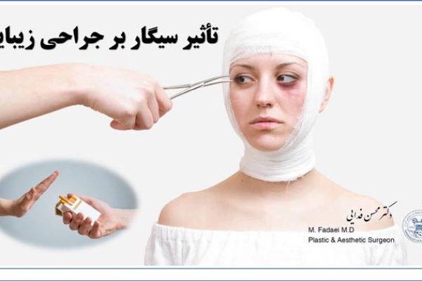 جراحی پلاستیک سیگار