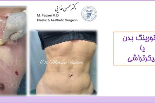 کانتورینگ بدن یا پیکرتراشی