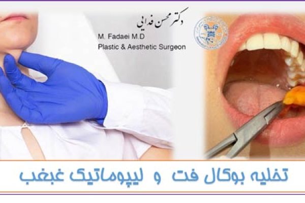 تخلیه چربی بوکال و لیپوماتیک غبغب