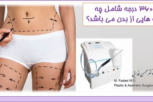 لیپو 360 درجه