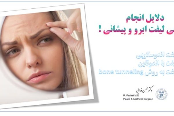 جراحی لیفت ابرو