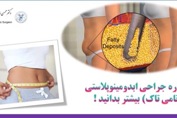 بهترین جراح ابدومینوپلاستی