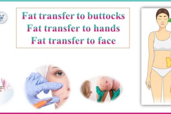 fat grafting
