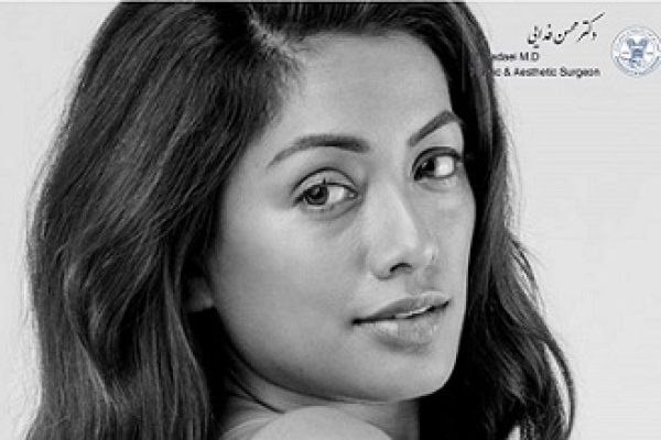 کوتاه کردن پیشانی