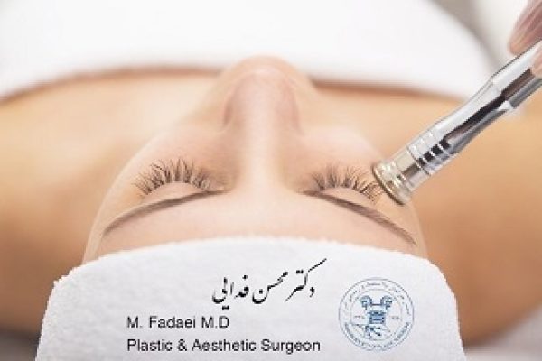 microdermabrasion