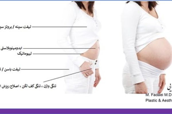 جراحی زیبایی همزمان با جراحی زنان | Cosmetic surgery and Gynecological surgery